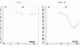 アバルト サスペンションのリセッティング<br>結果のbefore・after