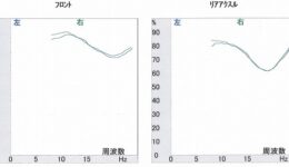 リファイン後のフレンチスポーツ 良い結果が出ています！